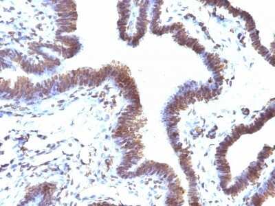 Immunohistochemistry-Paraffin: EMI1 Antibody (EMI1/1176) [NBP2-44344]