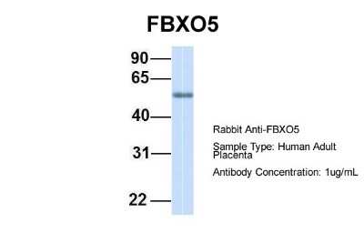Western Blot: EMI1 Antibody [NBP1-55050]