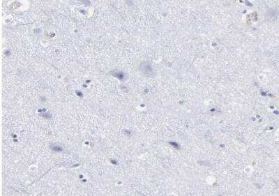 Immunohistochemistry-Paraffin: EMILIN1 Antibody [NBP1-84127]