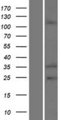 Western Blot: EMILIN2 Overexpression Lysate [NBP2-06082]
