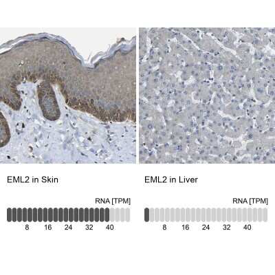 Immunohistochemistry-Paraffin: EML2 Antibody [NBP1-84861]