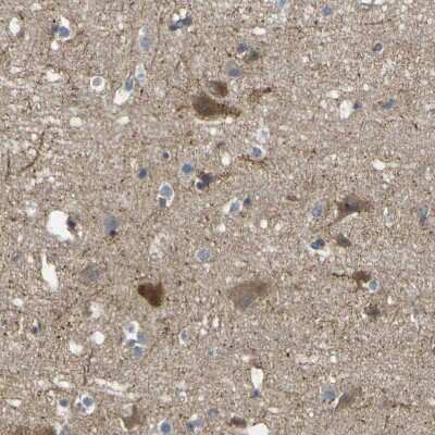 Immunohistochemistry-Paraffin: EML2 Antibody [NBP1-84861]