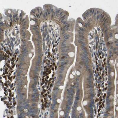 Immunohistochemistry-Paraffin: EML2 Antibody [NBP1-84861]