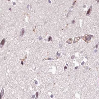 Immunohistochemistry-Paraffin: EML4 Antibody [NBP2-38319]