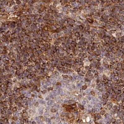 Immunohistochemistry-Paraffin: EML4 Antibody [NBP2-38319]