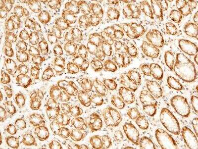 Immunohistochemistry-Paraffin: EMMPRIN/CD147 Antibody (125) [NBP2-89320]
