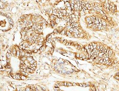 Immunohistochemistry-Paraffin: EMMPRIN/CD147 Antibody (125) [NBP2-89320]