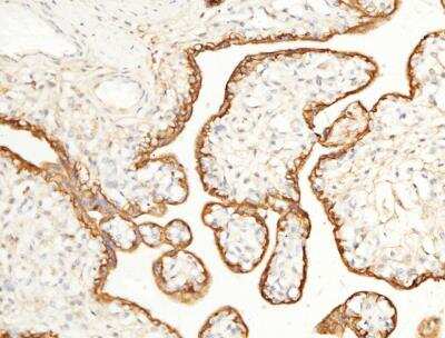 Immunohistochemistry-Paraffin: EMMPRIN/CD147 Antibody (125) [NBP2-89320]