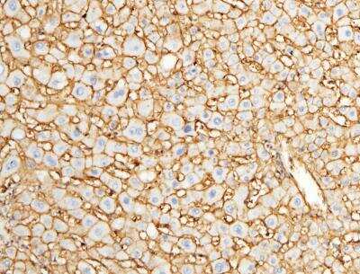 Immunohistochemistry-Paraffin: EMMPRIN/CD147 Antibody (125) [NBP2-89320]