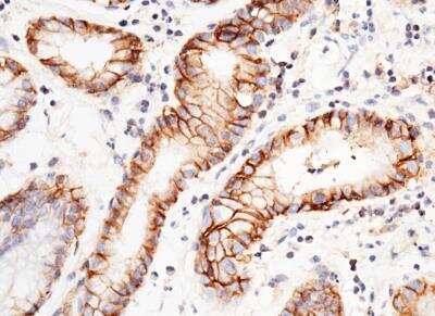 Immunohistochemistry-Paraffin: EMMPRIN/CD147 Antibody (125) [NBP2-89320]