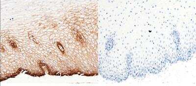 Immunohistochemistry-Paraffin: EMMPRIN/CD147 Antibody (125) [NBP2-89320]