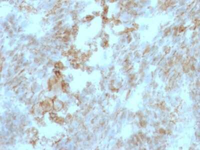 Immunohistochemistry-Paraffin: EMMPRIN/CD147 Antibody (BSG/963) [NBP2-44537]