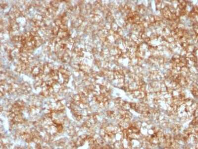 Immunohistochemistry-Paraffin: EMMPRIN/CD147 Antibody (BSG/963) [NBP2-44537]