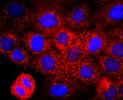 Immunocytochemistry/ Immunofluorescence: EMMPRIN/CD147 Antibody (JF1-045) [NBP2-66820]