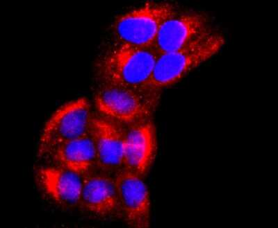 Immunocytochemistry/ Immunofluorescence: EMMPRIN/CD147 Antibody (JF1-045) [NBP2-66820]