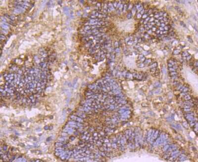 Immunohistochemistry-Paraffin: EMMPRIN/CD147 Antibody (JF1-045) [NBP2-66820]