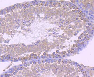 Immunohistochemistry-Paraffin: EMMPRIN/CD147 Antibody (JF1-045) [NBP2-66820]