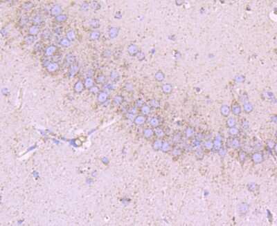 Immunohistochemistry-Paraffin: EMMPRIN/CD147 Antibody (JF1-045) [NBP2-66820]