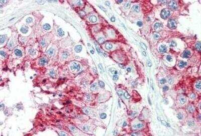 Immunohistochemistry-Paraffin: EMMPRIN/CD147 Antibody (MEM-M6/1) - BSA Free [NB500-430]