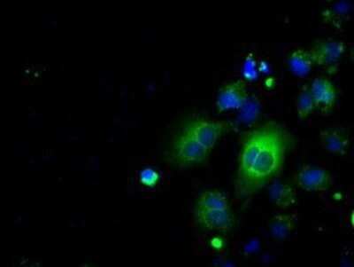 Immunocytochemistry/ Immunofluorescence: EMMPRIN/CD147 Antibody (OTI9H5) - Azide and BSA Free [NBP2-70278]