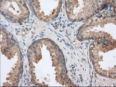 Immunohistochemistry: EMMPRIN/CD147 Antibody (OTI9H5) - Azide and BSA Free [NBP2-70278]