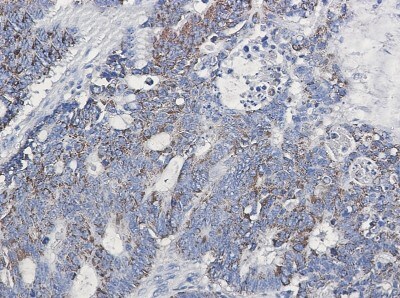 Immunohistochemistry-Paraffin: EMMPRIN/CD147 Antibody (S04-5B3) [NBP3-20062]
