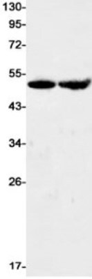 Western Blot: EMMPRIN/CD147 Antibody (S04-5B3) [NBP3-20062]