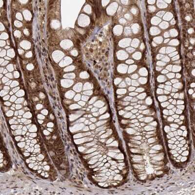 Immunohistochemistry-Paraffin: EMP/MAEA Antibody [NBP2-55034]