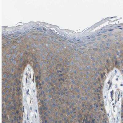 Immunohistochemistry-Paraffin: EMP2 Antibody [NBP1-86847]