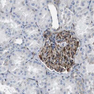 Immunohistochemistry-Paraffin: EMP2 Antibody [NBP1-86847]