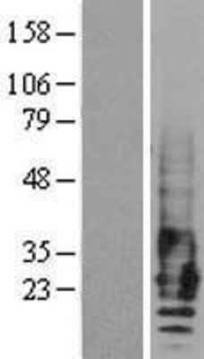 Western Blot: EMP2 Overexpression Lysate [NBL1-10260]