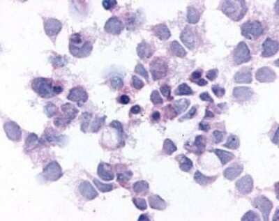 Immunohistochemistry-Paraffin: EMR2 Antibody - BSA Free [NLS1663]