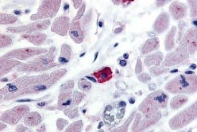Immunohistochemistry-Paraffin: EMR3 Antibody [NBP3-14560]