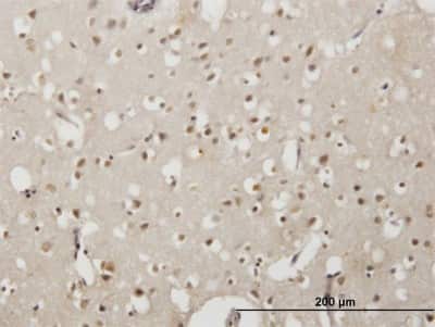 Immunohistochemistry-Paraffin: EMX2 Antibody (4F7) [H00002018-M06]