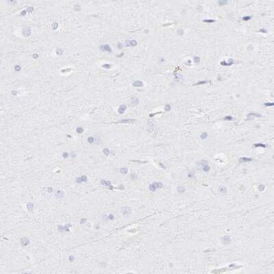 Immunohistochemistry-Paraffin: EN-RAGE/S100A12 Antibody [NBP1-86694]