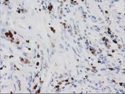Immunohistochemistry: EN-RAGE/S100A12 Antibody (OTI1D1) - Azide and BSA Free [NBP2-71276]