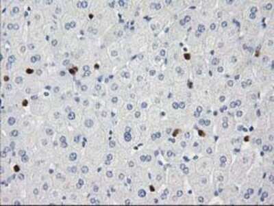 Immunohistochemistry: EN-RAGE/S100A12 Antibody (OTI1D1) - Azide and BSA Free [NBP2-71276]