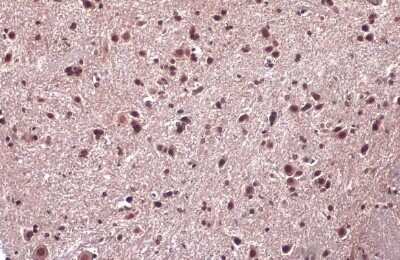 Immunohistochemistry-Paraffin: EN1/Engrailed 1 Antibody [NBP3-13332]