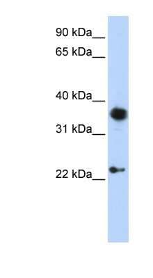 Western Blot: EN1/Engrailed 1 Antibody [NBP1-56532]