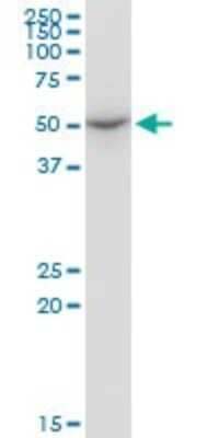Western Blot: ENDOGL1 Antibody (2F7) [H00009941-M02]