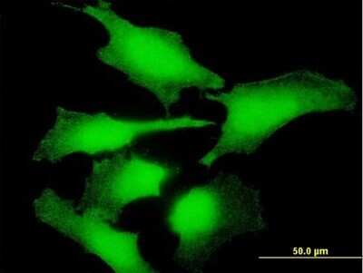 Immunocytochemistry/ Immunofluorescence: ENO1P Antibody [H00002025-B01P]