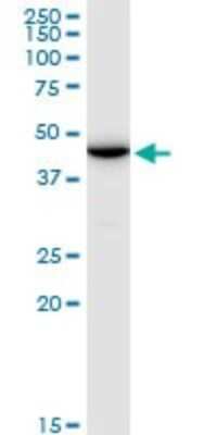 Western Blot: ENO1P Antibody [H00002025-B01P]