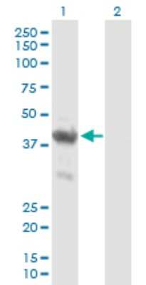 Western Blot: ENO1P Antibody [H00002025-B01P]