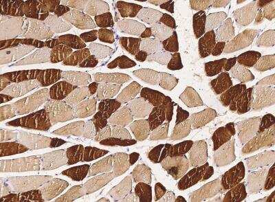 Immunohistochemistry-Paraffin: ENO3 Antibody (003) [NBP2-90274]