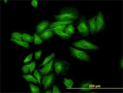 Immunocytochemistry/ Immunofluorescence: ENO3 Antibody (5D1) [H00002027-M01]