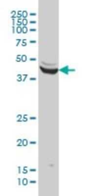 Western Blot: ENO3 Antibody (5D1) [H00002027-M01]
