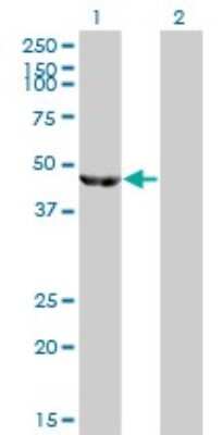 Western Blot: ENO3 Antibody (5D1) [H00002027-M01]