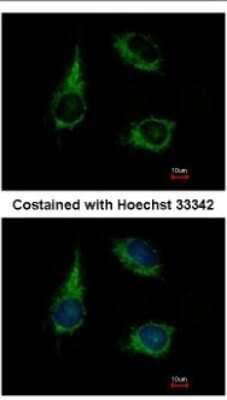 Immunocytochemistry/ Immunofluorescence: ENOSF1 Antibody [NBP2-16338]