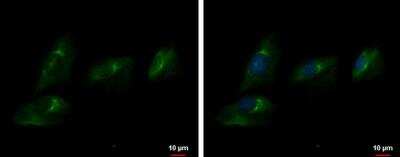 Immunocytochemistry/ Immunofluorescence: ENPP-2/Autotaxin Antibody [NBP1-32162]