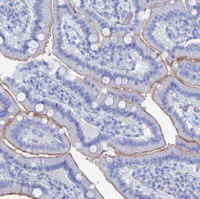 Immunohistochemistry-Paraffin: ENPP-3/CD203c Antibody [NBP1-88928]